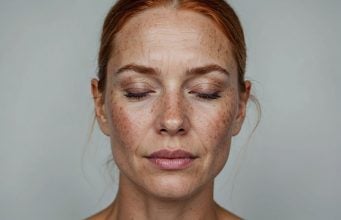 Combating the Effects of Aging: Dr. Jason Emer Reviews His Innovative Approach to Treating Sun Spots, Fine Lines, and Wrinkles Dr. Jason Emer Reviews His Innovative Approach to Treating Sun Spots, Fine Lines, and Wrinkles